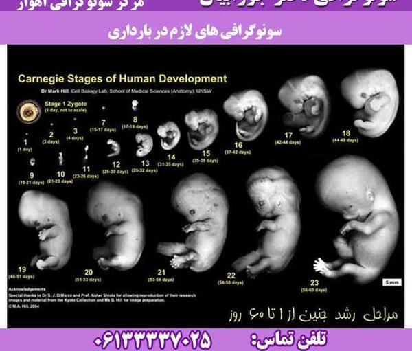 عکس جنین در هفته 32 بارداری
