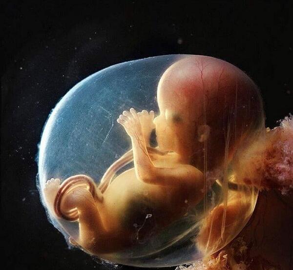 عکس جنین یک ماهه
