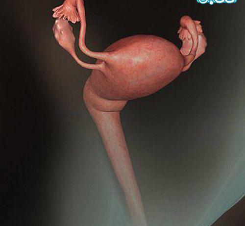 عکس جنین یک ماهه