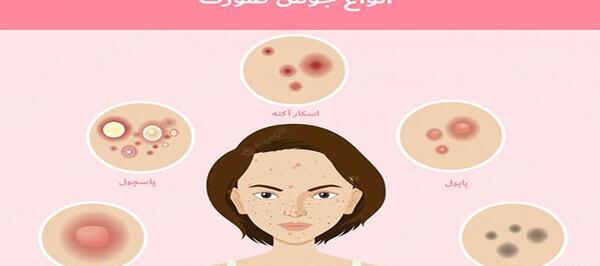 عکس انواع جوش