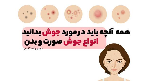 عکس انواع جوش