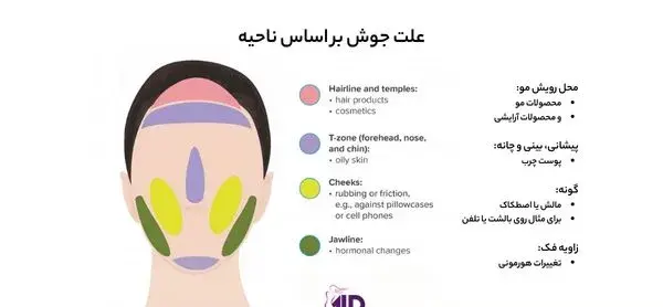 عکس انواع جوش