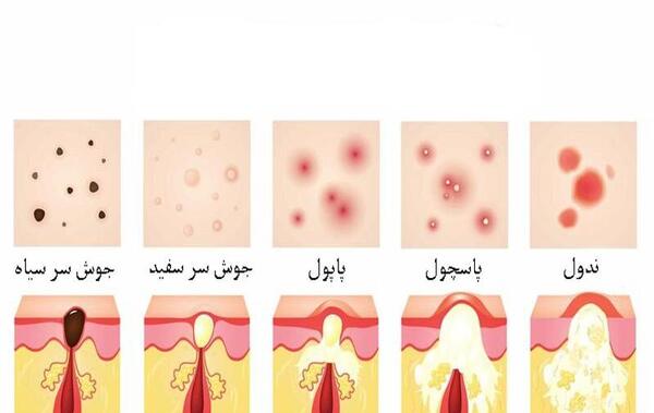 عکس انواع جوش
