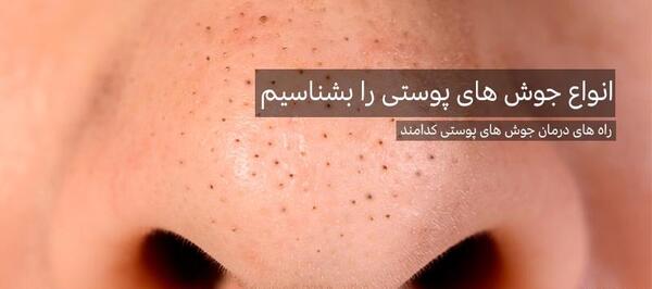 عکس انواع جوش