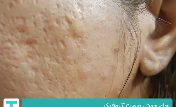 عکس انواع جوش