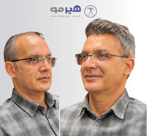 عکس موهای جو گندمی زنانه