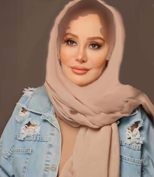عکس قبل عمل ارام جعفری