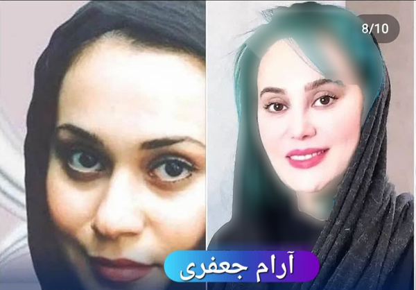عکس قبل عمل ارام جعفری