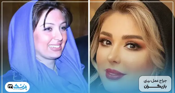 عکس قبل عمل ارام جعفری