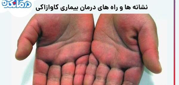 عکس چشم انتظاری بچه