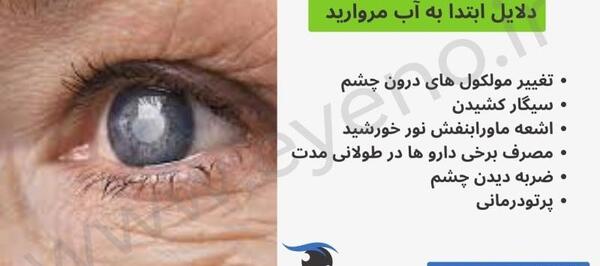 عکس از آب مروارید چشم