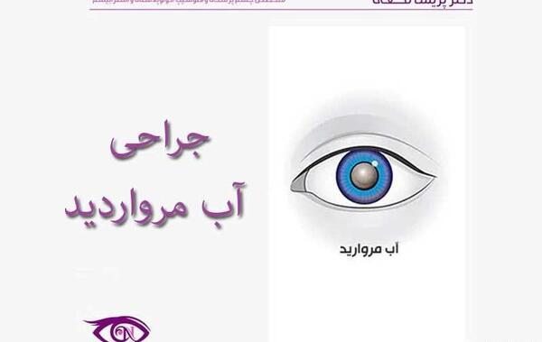 عکس از آب مروارید چشم