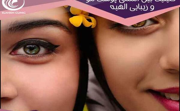 عکس چشم با متن زیبا