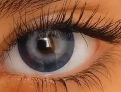 عکس چشم طوسی خاکستری