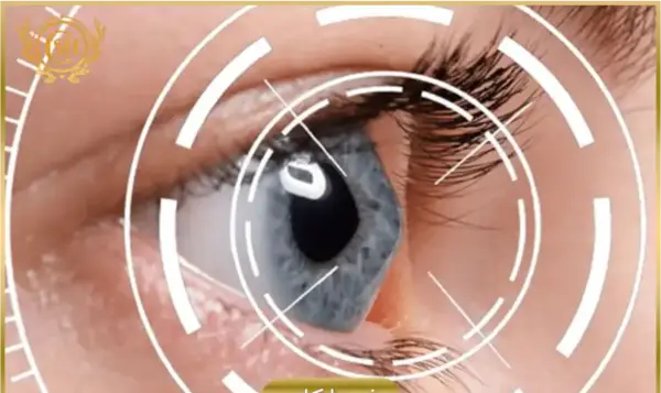 عکس قرنیه چشم چیست