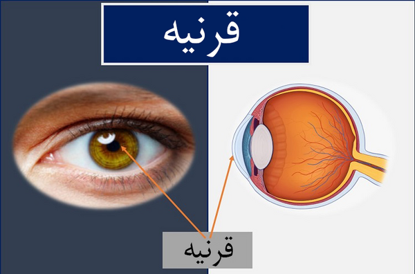 عکس قرنیه چشم چیست
