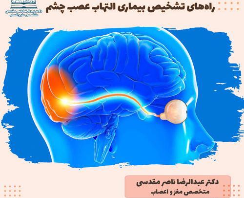 عکس عصب چشم چیست
