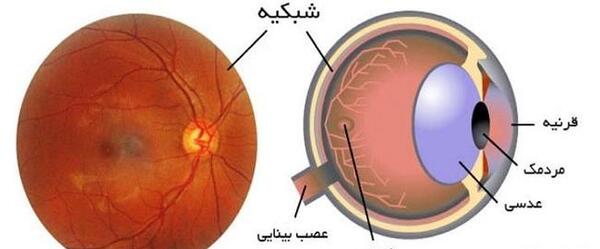 عکس عصب چشم چیست