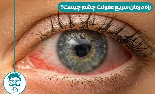 عکس چشم نشانه چیست