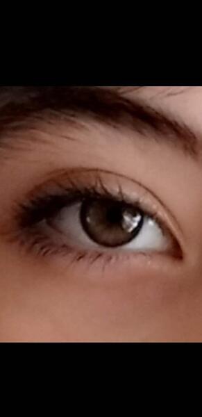 عکس چشم زاغی