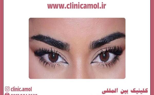 عکس خط چشم روباهی