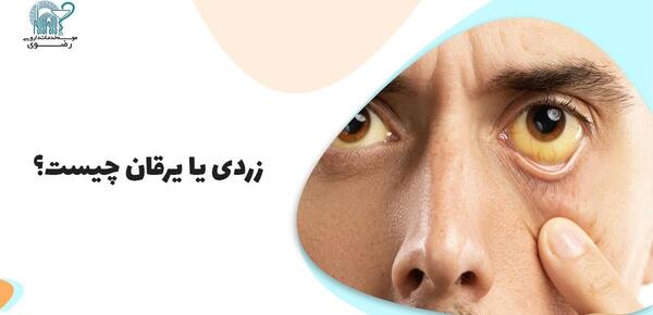 عکس ژل چشمی لیپوزیک