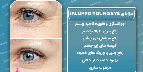 عکس مزو ژل زیر چشم