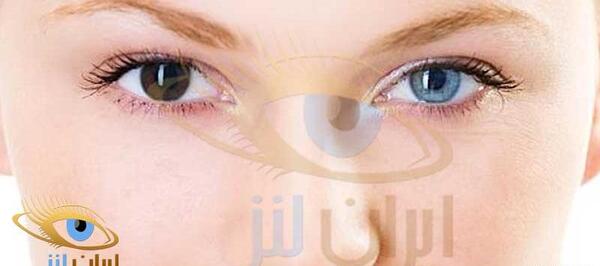 عکس رنگی چشم در شیراز