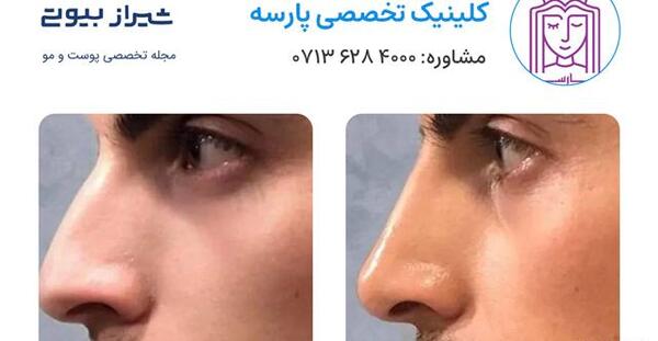 عکس رنگی چشم در شیراز