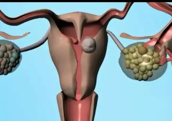 عکس رنگی چشم در شیراز