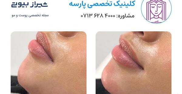 عکس رنگی چشم در شیراز