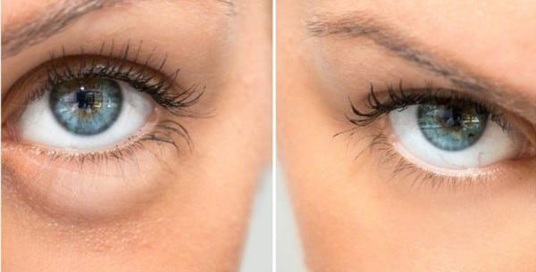 عکس فیلر چشم