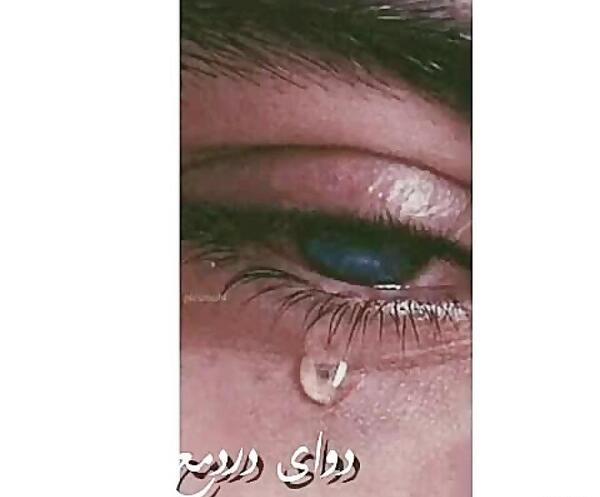 عکس چشم قرمز پسر