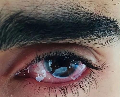 عکس چشم گریه فیک