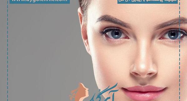 عکس چشم گربه ای طبیعی