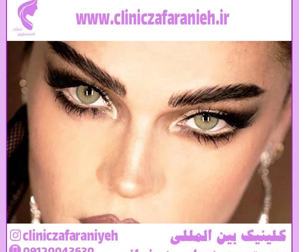 عکس چشم گربه ای طبیعی