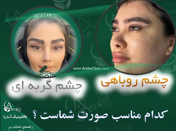 عکس چشم گربه ای طبیعی
