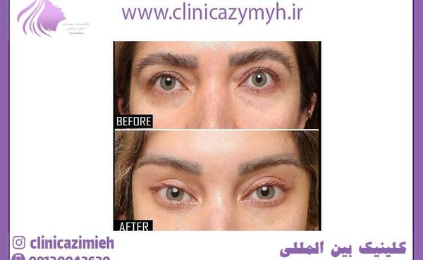 عکس چشم گربه ای طبیعی