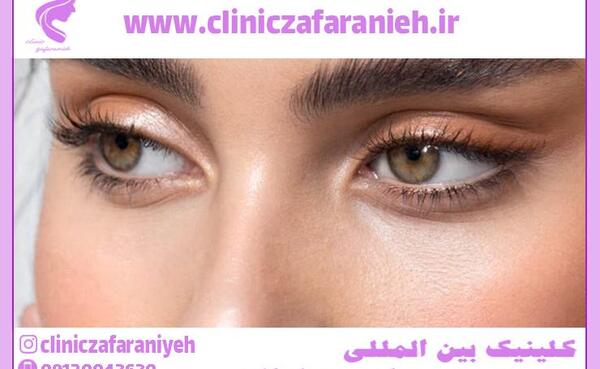 عکس چشم گربه ای طبیعی