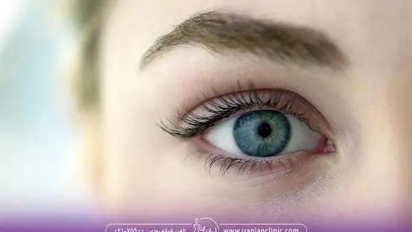 عکس چشم گربه ای طبیعی