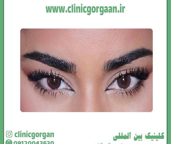 عکس چشم گربه ای طبیعی
