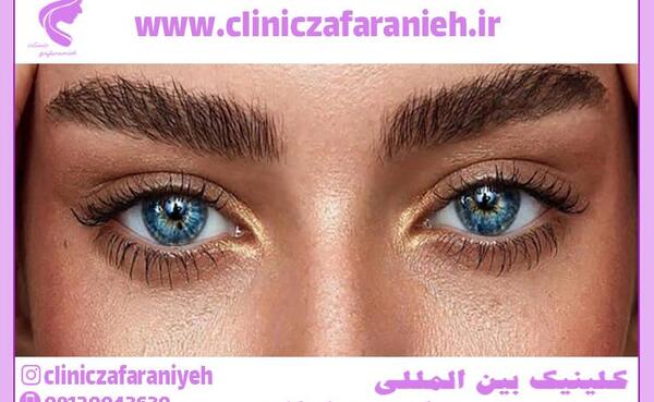 عکس چشم گربه ای طبیعی