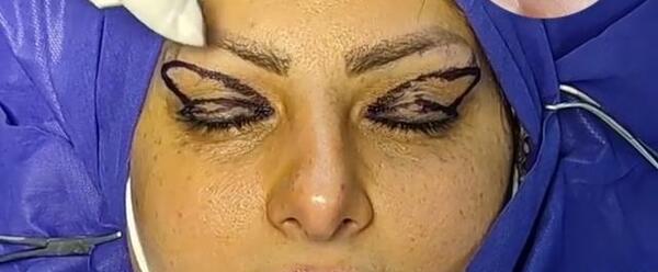 عکس چشم گربه ای طبیعی