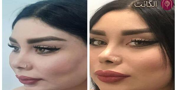 عکس چشم گربه ای طبیعی