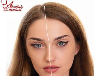 عکس چشم گربه ای طبیعی