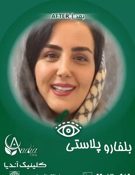 عکس چشم گربه ای طبیعی