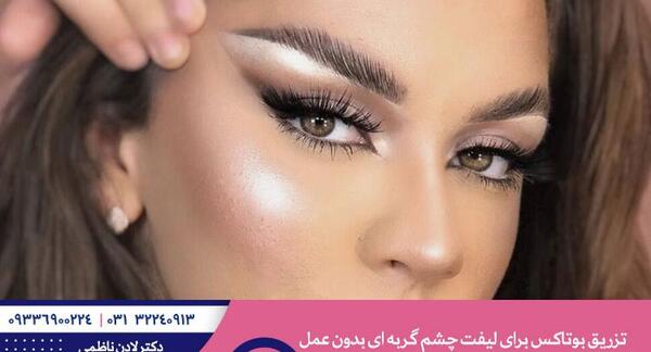 عکس چشم گربه ای طبیعی