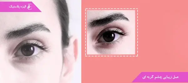 عکس چشم گربه ای طبیعی