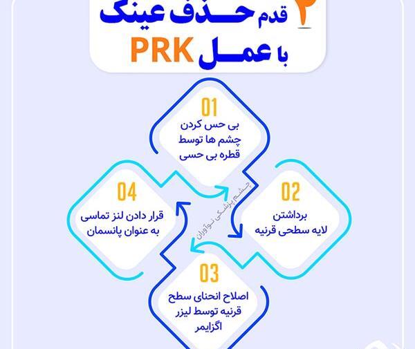 عکس چشم برای لیزیک