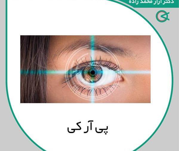 عکس از چشم برای لیزیک